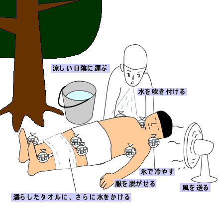 熱中症の応急処置