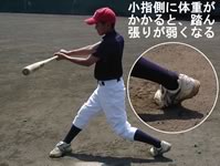 小指側に体重がかかっている悪い例